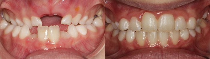 orthodontist clinton