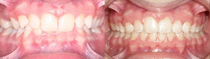 orthodontist clinton