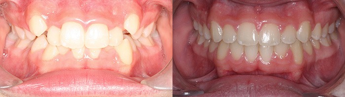 orthodontist clinton