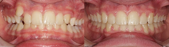 orthodontist clinton