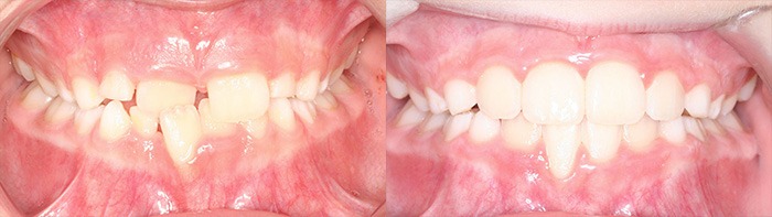 orthodontist clinton