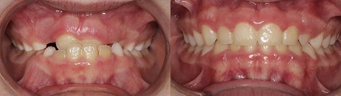 orthodontist clinton