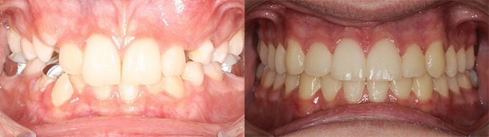 orthodontist clinton