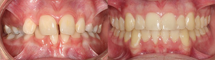 orthodontist clinton