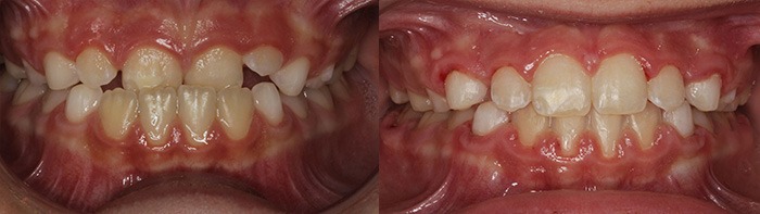 orthodontist clinton