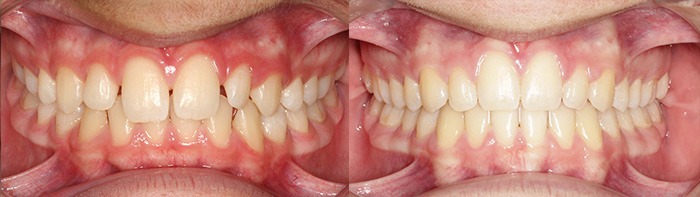 orthodontist clinton