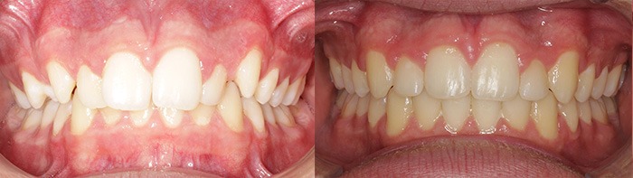 orthodontist clinton