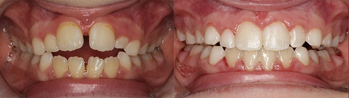 orthodontist clinton