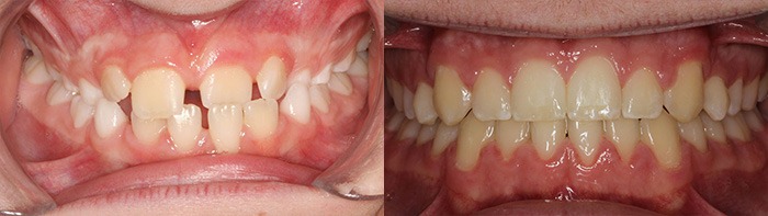 orthodontist clinton