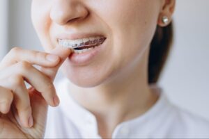 10 Braces and Aligner Tips for Everyday Success