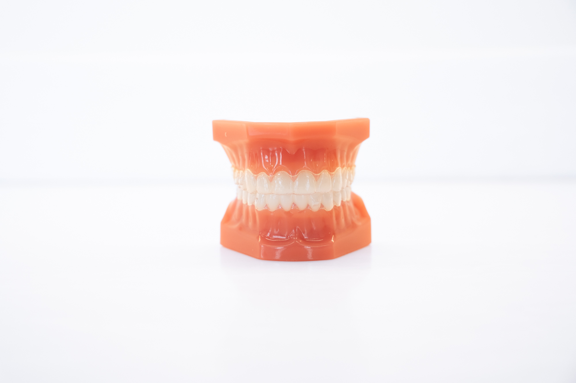Clear Aligners
