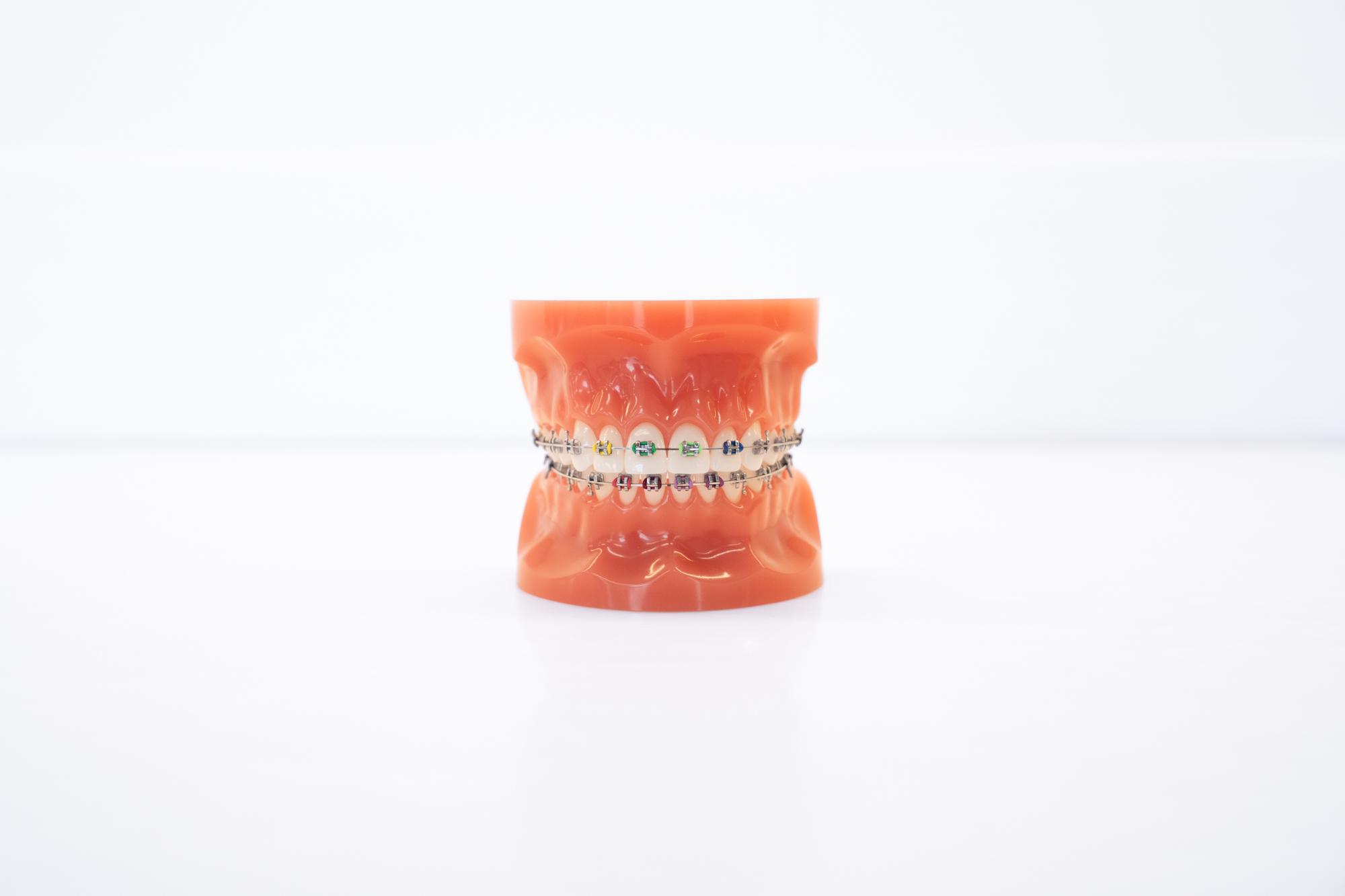 Metal Braces