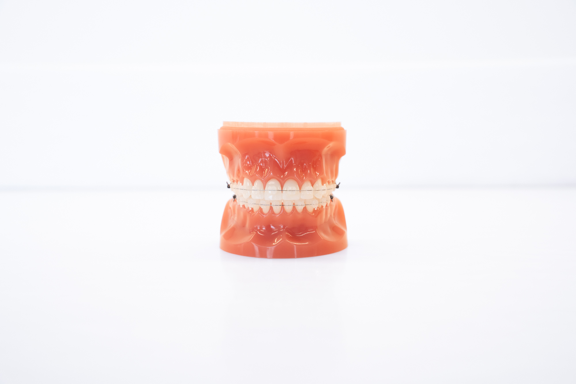 Clear Braces